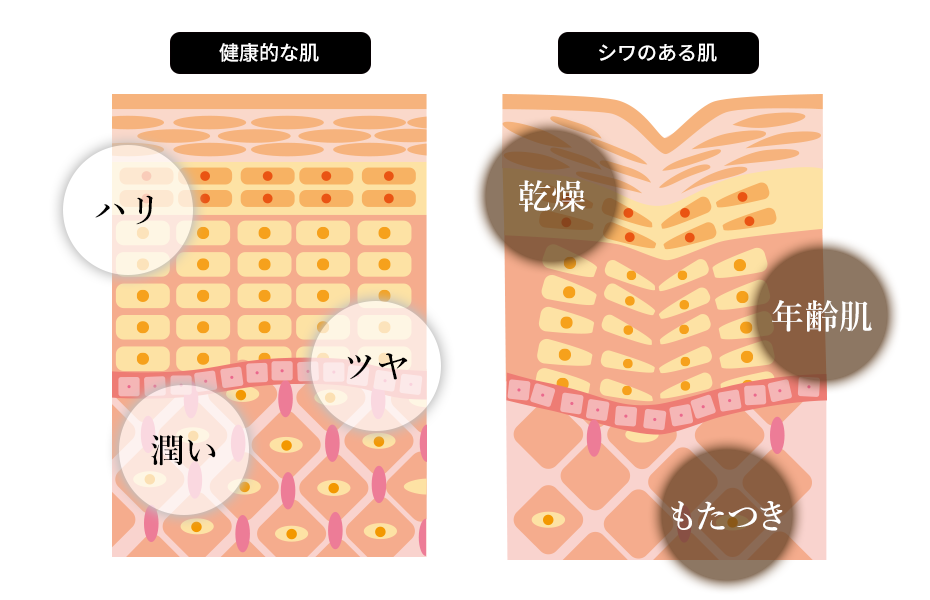 健康的な肌とシワのある肌の違い